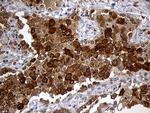 GRB7 Antibody in Immunohistochemistry (Paraffin) (IHC (P))