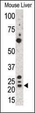 GREM1 Antibody in Western Blot (WB)