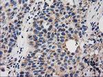 GRHPR Antibody in Immunohistochemistry (Paraffin) (IHC (P))