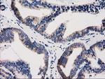 GRHPR Antibody in Immunohistochemistry (Paraffin) (IHC (P))