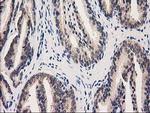 GRHPR Antibody in Immunohistochemistry (Paraffin) (IHC (P))