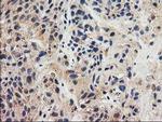 GRHPR Antibody in Immunohistochemistry (Paraffin) (IHC (P))