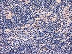 GRHPR Antibody in Immunohistochemistry (Paraffin) (IHC (P))