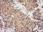 GRHPR Antibody in Immunohistochemistry (Paraffin) (IHC (P))