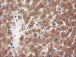 GRHPR Antibody in Immunohistochemistry (Paraffin) (IHC (P))