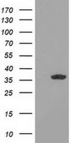 GRHPR Antibody in Western Blot (WB)