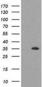 GRHPR Antibody in Western Blot (WB)