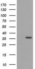 GRHPR Antibody in Western Blot (WB)