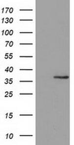 GRHPR Antibody in Western Blot (WB)