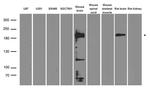 GRIN2A Antibody in Western Blot (WB)