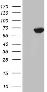 GRK1 Antibody in Western Blot (WB)