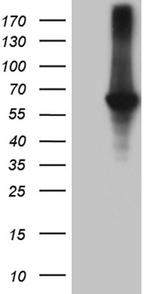 GRK1 Antibody in Western Blot (WB)