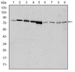 GRK2 Antibody in Western Blot (WB)