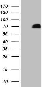 GRK4 Antibody in Western Blot (WB)