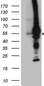 GRK5 Antibody in Western Blot (WB)