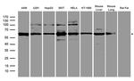 GRK5 Antibody in Western Blot (WB)