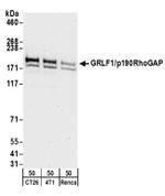 GRLF1/p190RhoGAP Antibody in Western Blot (WB)