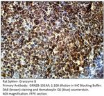 Granzyme B Antibody in Immunohistochemistry (IHC)