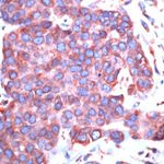 GRP78 Antibody in Immunohistochemistry (Paraffin) (IHC (P))