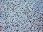 GSC Antibody in Immunohistochemistry (Paraffin) (IHC (P))