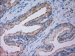 GSC Antibody in Immunohistochemistry (Paraffin) (IHC (P))