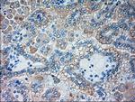 GSC Antibody in Immunohistochemistry (Paraffin) (IHC (P))