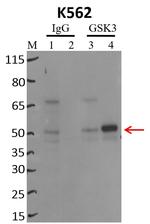 GSK3 alpha/beta Antibody in Immunoprecipitation (IP)