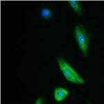 GST Tag Antibody in Immunocytochemistry (ICC/IF)