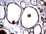 GSTP1 Antibody in Immunohistochemistry (Paraffin) (IHC (P))