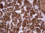 GSTP1 Antibody in Immunohistochemistry (Paraffin) (IHC (P))