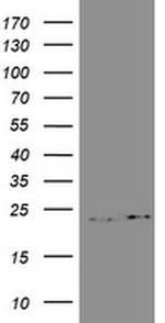 GSTP1 Antibody in Western Blot (WB)