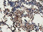 GSTT2 Antibody in Immunohistochemistry (Paraffin) (IHC (P))