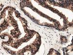 GSTT2 Antibody in Immunohistochemistry (Paraffin) (IHC (P))