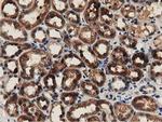 GSTT2 Antibody in Immunohistochemistry (Paraffin) (IHC (P))