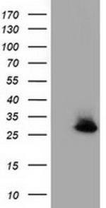 GSTT2 Antibody in Western Blot (WB)