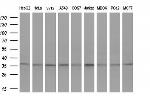 GTF2B Antibody in Western Blot (WB)