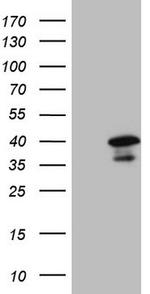 GTF2B Antibody in Western Blot (WB)