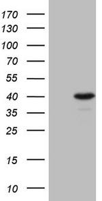 GTF2B Antibody in Western Blot (WB)