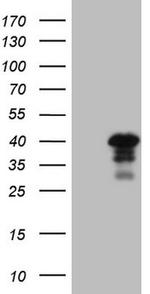 GTF2B Antibody in Western Blot (WB)