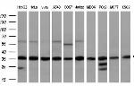 GTF2B Antibody in Western Blot (WB)