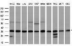 GTF2B Antibody in Western Blot (WB)