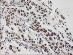 GTF2F1 Antibody in Immunohistochemistry (Paraffin) (IHC (P))