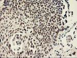 GTF2F1 Antibody in Immunohistochemistry (Paraffin) (IHC (P))