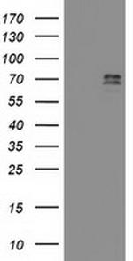 GTF2F1 Antibody in Western Blot (WB)