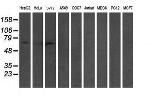 GTF2F1 Antibody in Western Blot (WB)