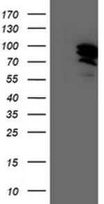 GTF2F1 Antibody in Western Blot (WB)