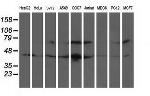 GTF2F1 Antibody in Western Blot (WB)