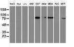 GTF2F1 Antibody in Western Blot (WB)