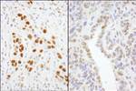 GTF2I/TFII-I Antibody in Immunohistochemistry (IHC)