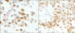 GTF2I/TFII-I Antibody in Immunohistochemistry (IHC)